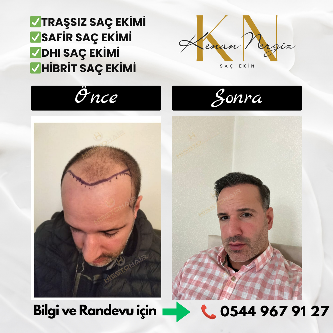 Bayraklı Saç Ekim Merkezi