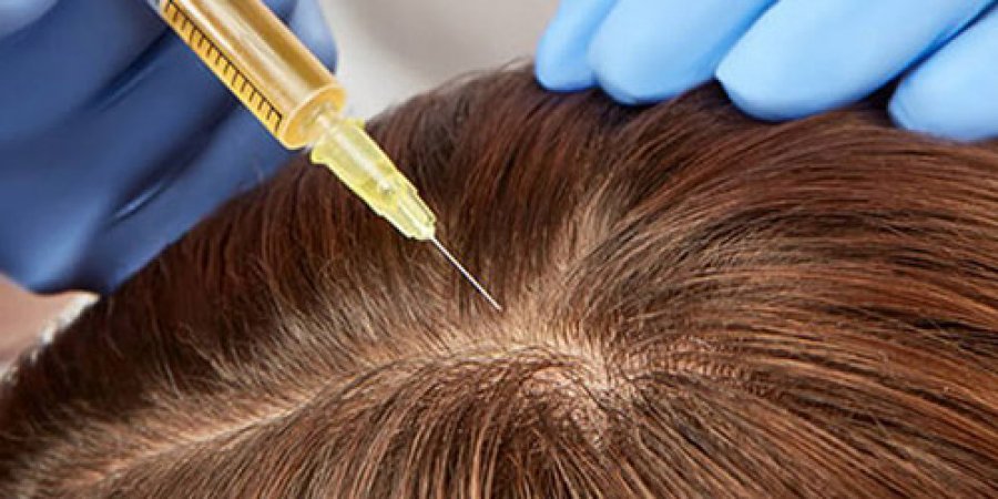 Saç PRP Tedavisi İzmir - Kemalpaşa