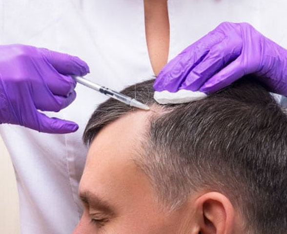 Saç PRP Tedavisi İzmir - Kemalpaşa